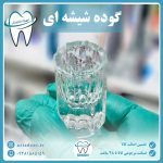 گوده شیشه ای