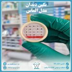 نگین دندان مدل الماس